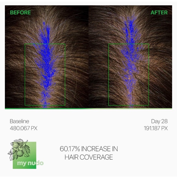 Moroccan Gold My Nudo Rejuvenating Volumizing Shampoo Hair Loss & Thinning - Picture 9 of 9